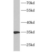 WB analysis of mouse testis tissue, using ANKRD54 antibody (1/1000 dilution).
