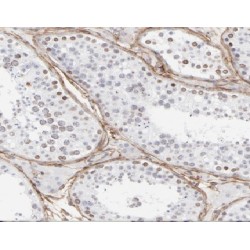 Ankyrin Repeat And Sterile Alpha Motif Domain Containing 1B (ANKS1B) Antibody