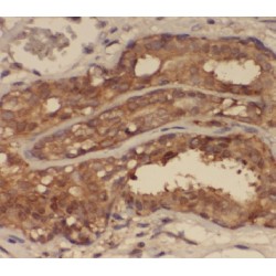 Ankyrin Repeat And Sterile Alpha Motif Domain Containing 3 (ANKS3) Antibody