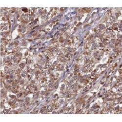Annexin A11 (ANXA11) Antibody