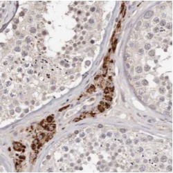 Anoctamin-10 (ANO10) Antibody
