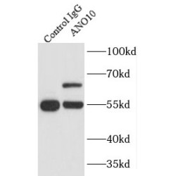 Anoctamin-10 (ANO10) Antibody