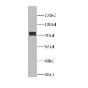WB analysis of HEK-293 cells, using ANTXR2 antibody (1/600 dilution).