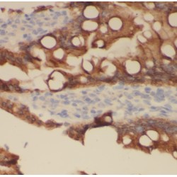 Acyloxyacyl Hydrolase (AOAH) Antibody