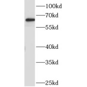 WB analysis of mouse colon tissue, using AOAH antibody (1/500 dilution).