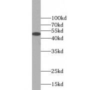 WB analysis of human brain tissue, using AP1M1 antibody (1/400 dilution).