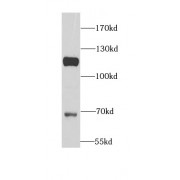 WB analysis of various lysates, using AP2B1 antibody (1/1000 dilution).