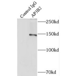 AP-3 Complex Subunit Beta-2 (AP3B2) Antibody
