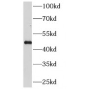 WB analysis of human brain tissue, using AP3M2 antibody (1/200 dilution).