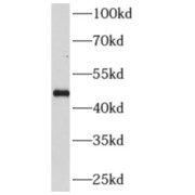 WB analysis of human brain tissue, using AP3M2 antibody (1/200 dilution).