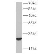 WB analysis of human testis tissue, using AP3S2 antibody (1/800 dilution).
