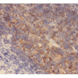 AP-4 Complex Subunit Mu-1 (AP4M1) Antibody