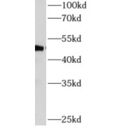 WB analysis of mouse heart tissue, using AP4M1 antibody (1/600 dilution).