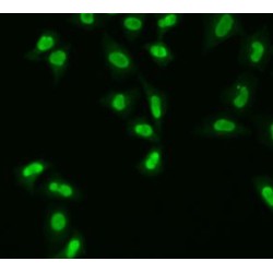 DNA-(Apurinic Or Apyrimidinic Site) Lyase (APEX1) Antibody