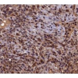 DNA-(Apurinic Or Apyrimidinic Site) Lyase (APEX1) Antibody