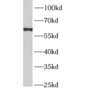 WB analysis of PC-3 cells, using APLF antibody (1/600 dilution).