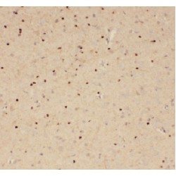 Amyloid Beta Precursor Like Protein 2 (APLP2) Antibody