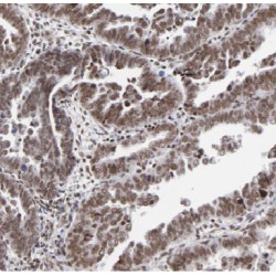 Apolipoprotein B mRNA Editing Enzyme Catalytic Subunit 3C (APOBEC3C) Antibody