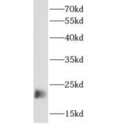 WB analysis of Human peripheral blood leukocyte cells, using APOBEC3C antibody (1/1000 dilution).