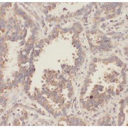 Apolipoprotein L2 (APOL2) Antibody