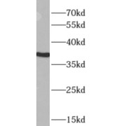 abx230504