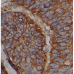 Apolipoprotein M (APOM) Antibody