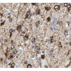 Beta-Amyloid Precursor Protein (APP) Antibody