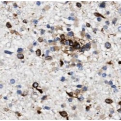Amyloid-beta Precursor Protein (APP) Antibody