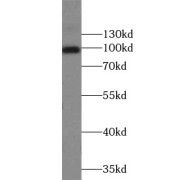 WB analysis of HEK-293 cells, using APP antibody (1/1000 dilution).
