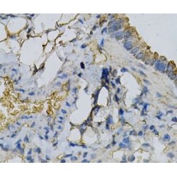 Adenine Phosphoribosyltransferase (APRT) Antibody
