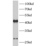 Western blot analysis of Human heart tissue, using Aquaporin 1 Antibody (1/500 dilution).