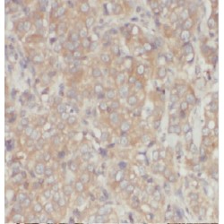 N-Alpha-Acetyltransferase 10 (ARD1A) Antibody