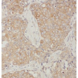 ADP-Ribosylation Factor 1 (ARF1) Antibody