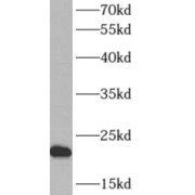 WB analysis of MCF7 cells, using ARF5 antibody (1/500 dilution).
