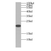WB analysis of mouse colon tissue, using ARF5-Specific antibody (1/300 dilution).