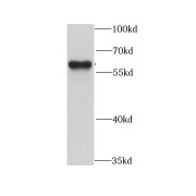 WB analysis of HepG2 cells, using ARFGAP3 antibody (1/1000 dilution).