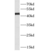 WB analysis of HeLa cells, using ARFIP1 antibody (1/500 dilution).