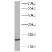 WB analysis of 293T cells, using ARFRP1 antibody (1/500 dilution).