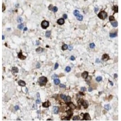 Rho GTPase-Activating Protein 15 (ARHGAP15) Antibody