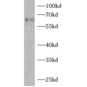 abx230547