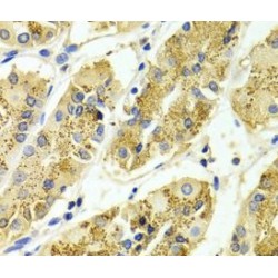 Rho GTPase Activating Protein 25 (ARHGAP25) Antibody
