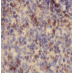 Rho GTPase Activating Protein 4 (ARHGAP4) Antibody