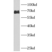 WB analysis of Jurkat cells, using ARHGAP9 antibody (1/1000 dilution).