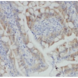 Rho Guanine Nucleotide Exchange Factor 1 (ARHGEF1) Antibody