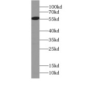 WB analysis of HeLa cells, using ARHGEF9-Specific antibody (1/300 dilution).