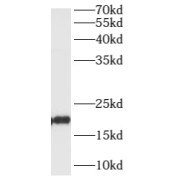 WB analysis of HeLa cells, using ARL1 antibody (1/600 dilution).