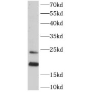 WB analysis of mouse liver tissue, using ARL2 antibody (1/500 dilution).