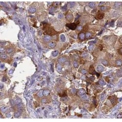 Actin-Related Protein 2 (ACTR2) Antibody