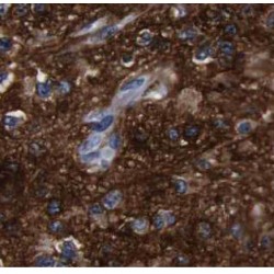 Actin Related Protein 2/3 Complex Subunit 5 (ARPC5) Antibody