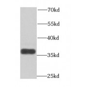 WB analysis of mouse testis tissue, using ART5 antibody (1/1000 dilution).